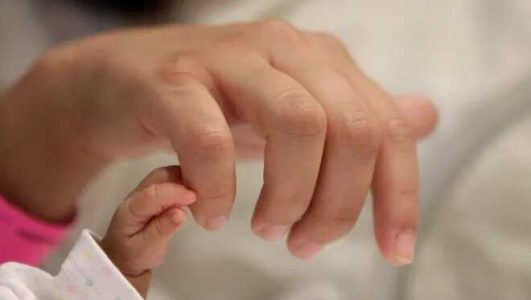 بارداری | رژیم غذایی ویژگی های صورت نوزاد تحت تاثیر رژیم غذایی دوران بارداری
