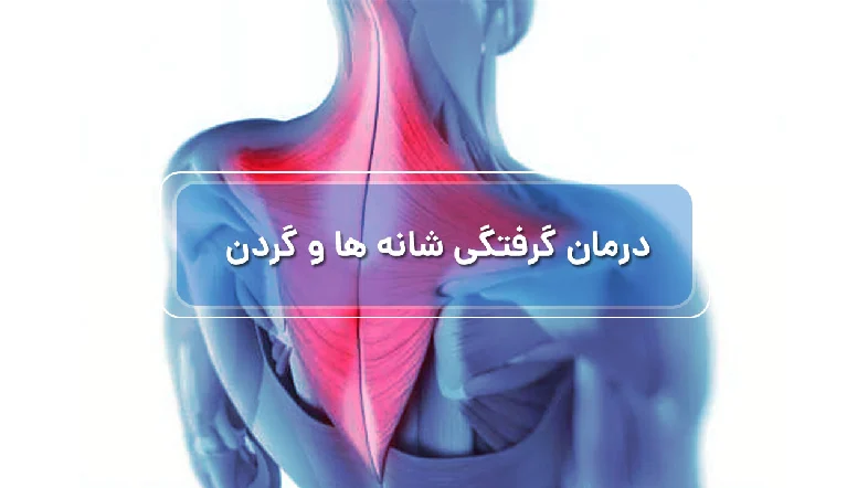 ۹ روش تضمینی برای درمان سریع گرفتگی گردن و شانه ها